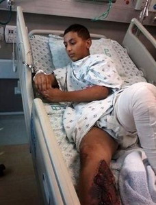  الطفل الاسير عيسى المعطي مهدد ببتر قدمه اليمنى بعد اصابته برصاص الاحتلال 